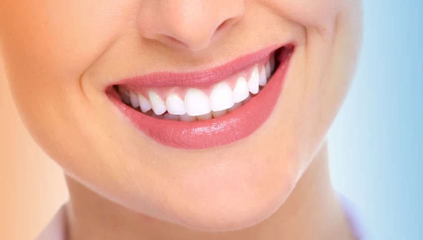 Smaids Reklamā Hollywood Smile Ungārija : Cena 2026, Atsauksmes, Pirms Pēc